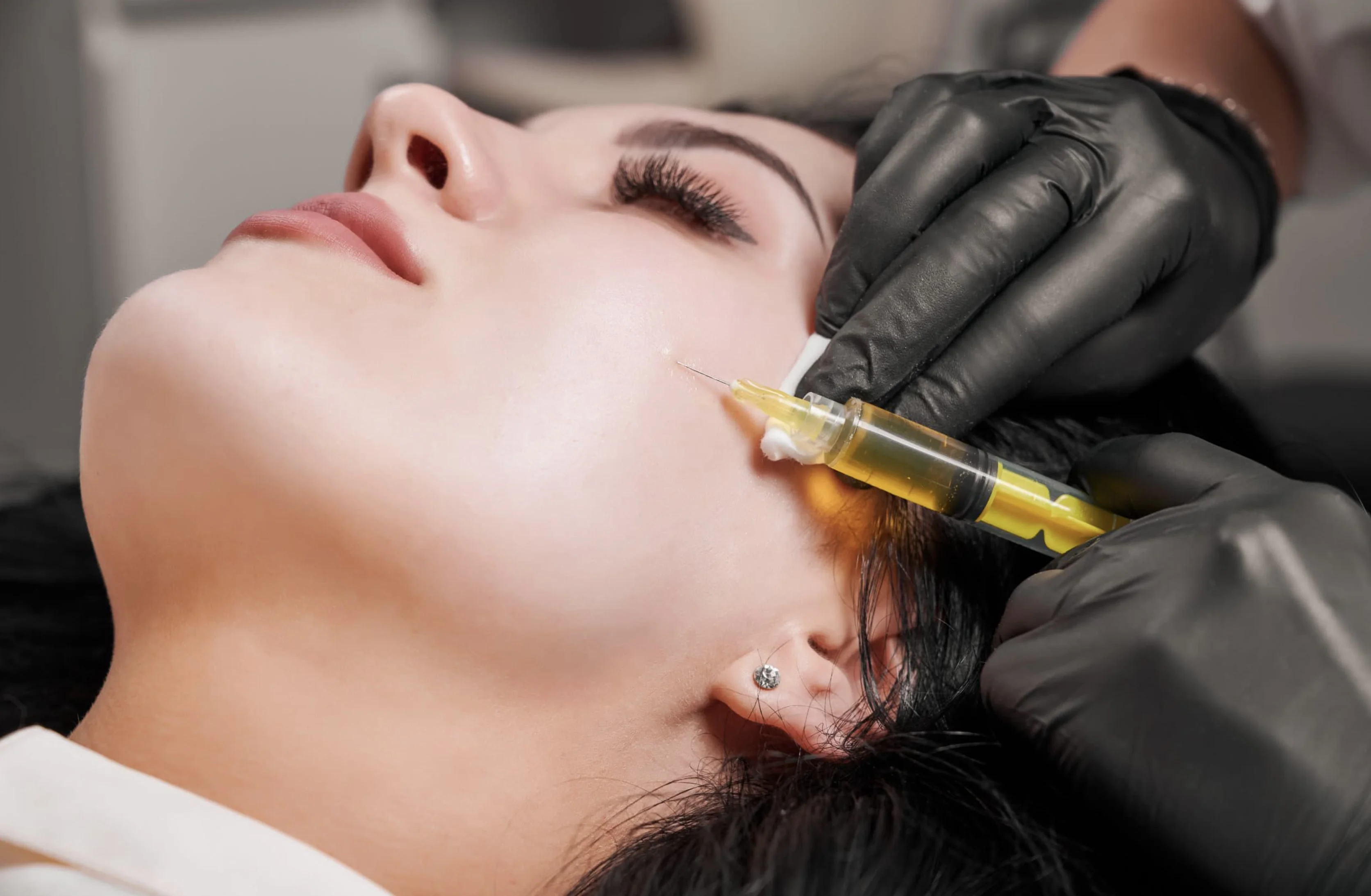 Platelet-Rich Plasma (PRP) therapy